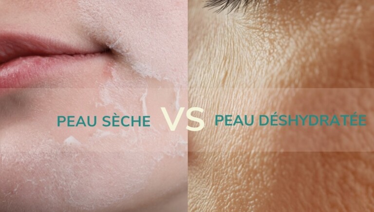 Différence entre peau sèche et peau déshydratée