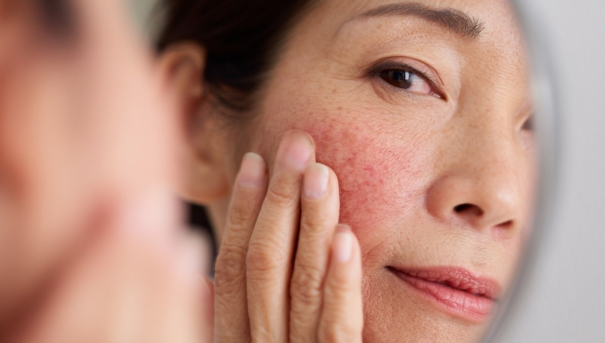 Femme observant des rougeurs au visage et réfléchissant à un soin visage anti rougeur adapté